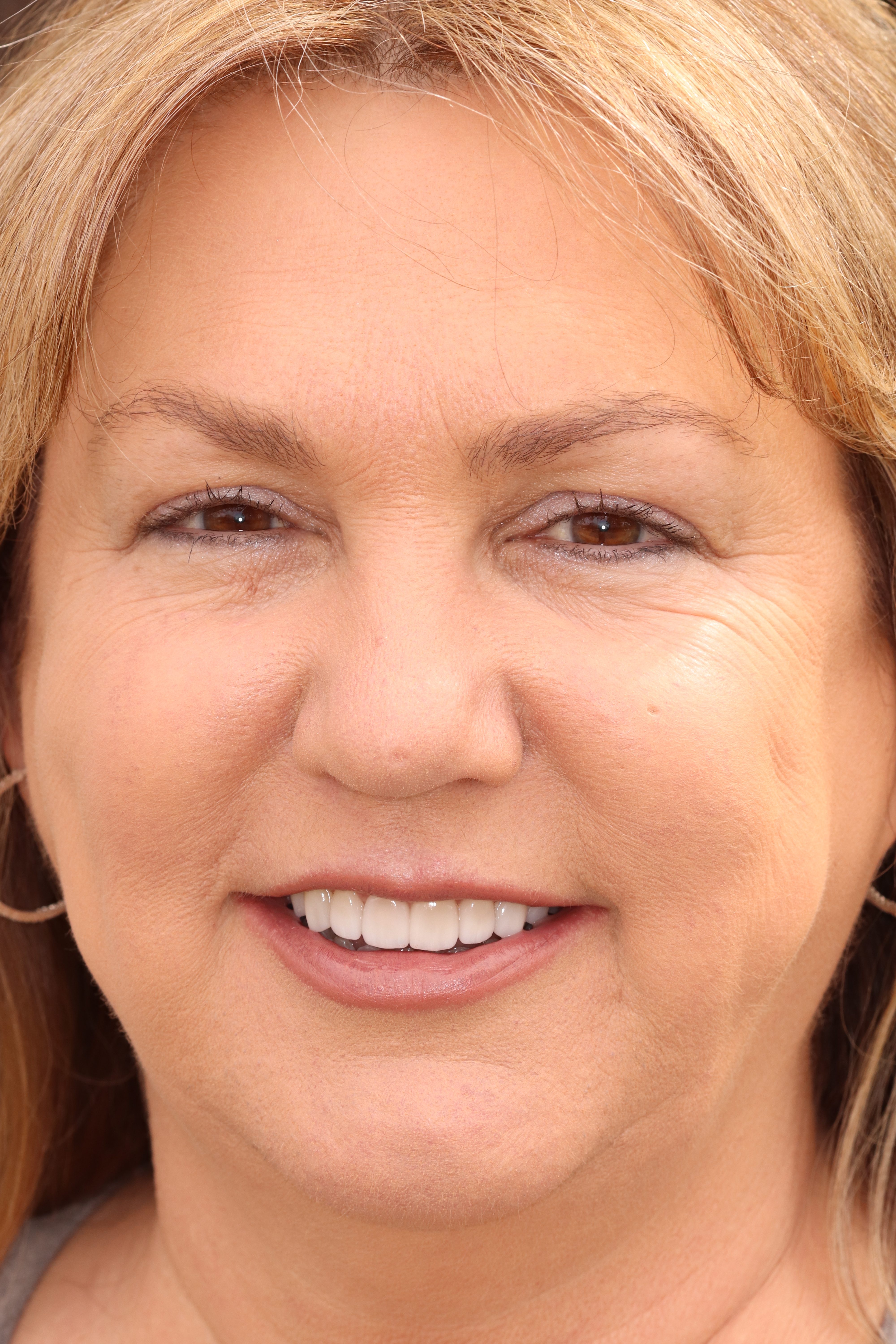 Smiling woman with a bright, healthy smile, showcasing aesthetic dental results, relevant to Evolve Dental's cosmetic dentistry services.